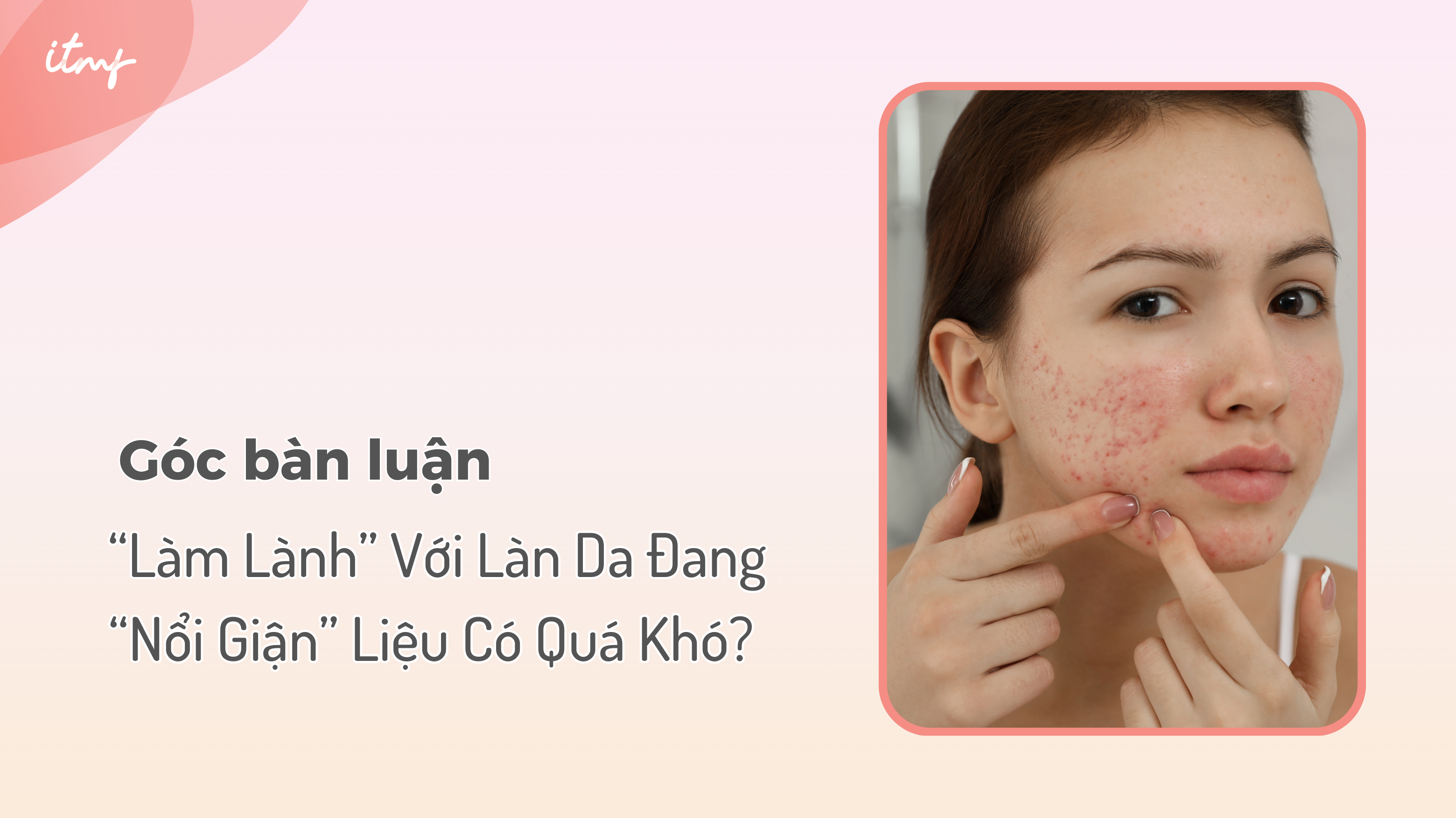 “Làm Lành” Với Làn Da Đang “Nổi Giận” Liệu Có Quá Khó?